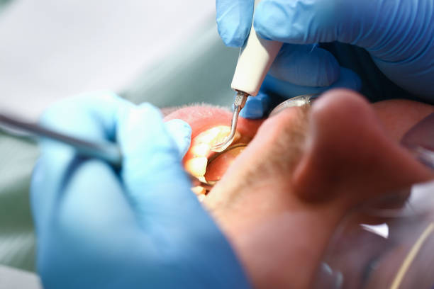 Best Weekend Emergency Dentist in Pine Level, NC