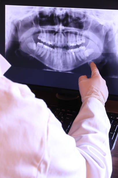 Best Emergency Root Canal Treatment in Pine Level, NC
