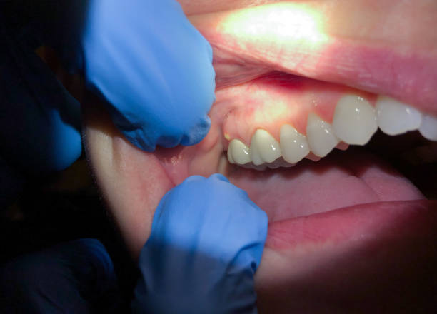 Best Weekend Emergency Dentist in Pine Level, NC